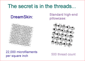 threads